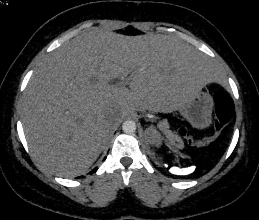 CTisus Case Studies