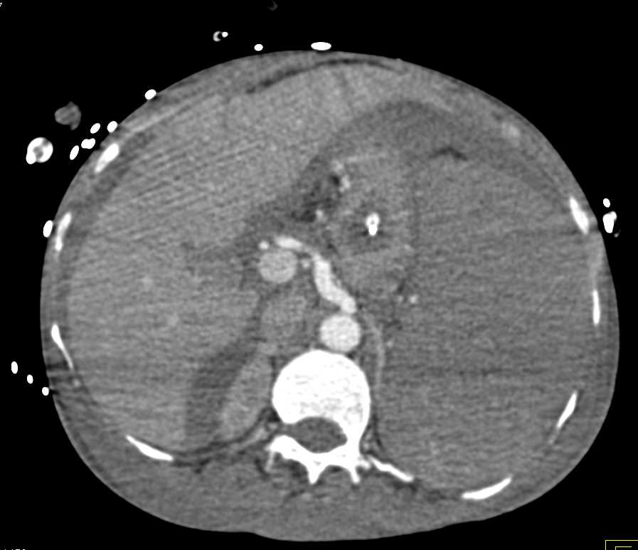 CTisus Case Studies