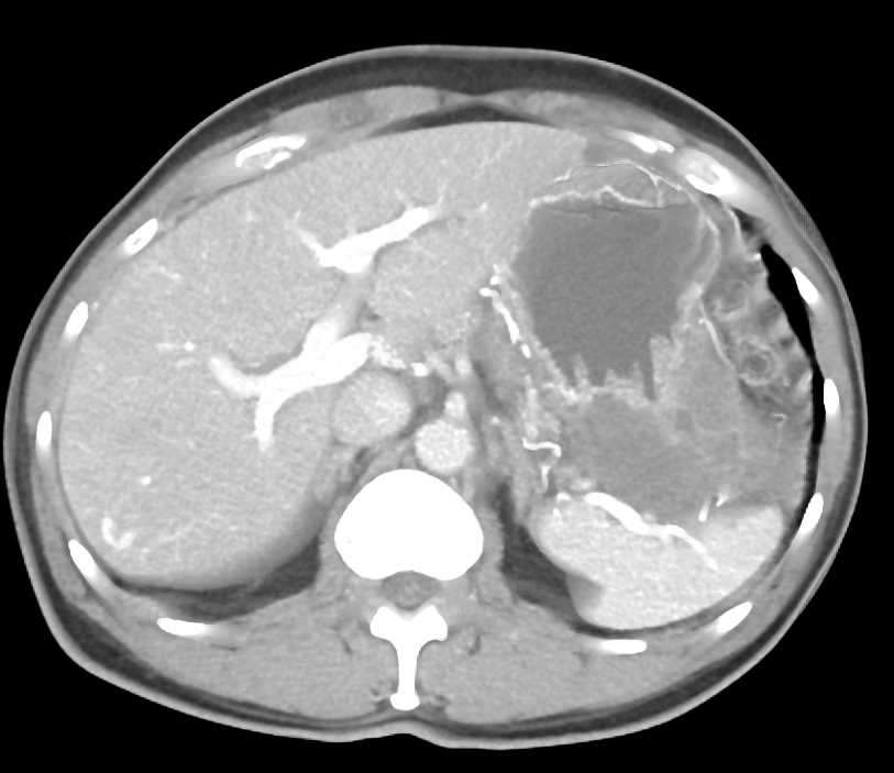 CTisus Case Studies