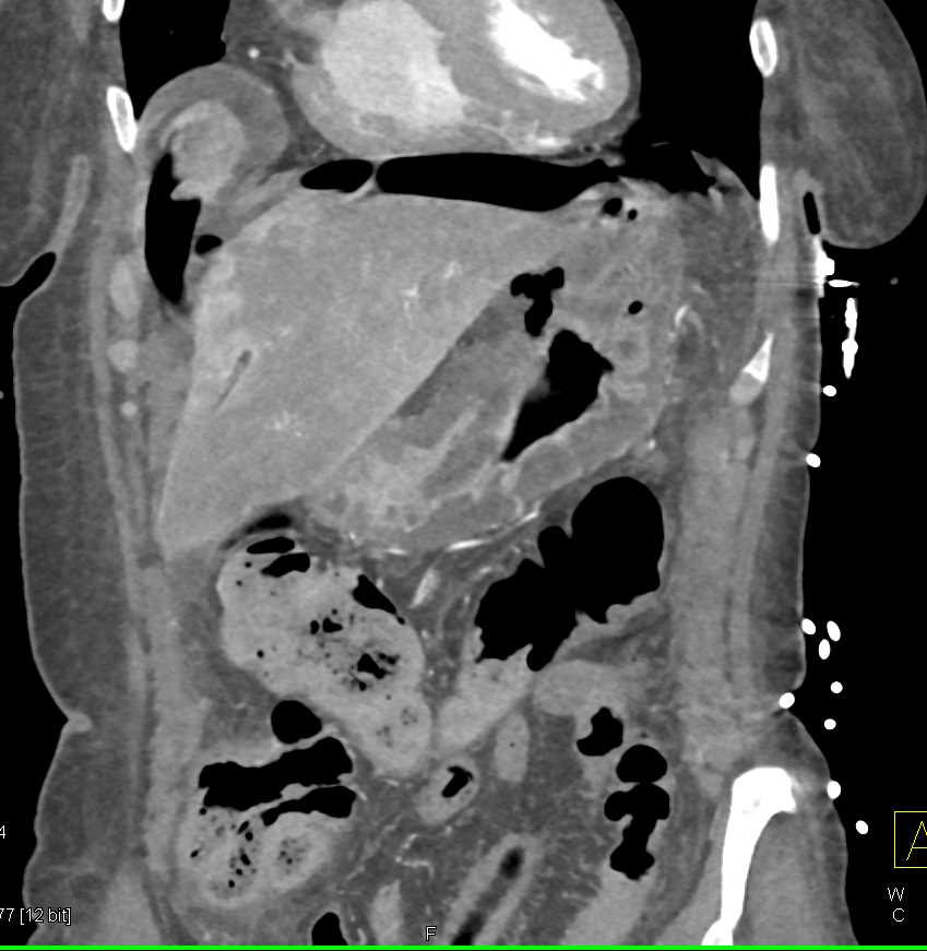 CTisus Case Studies