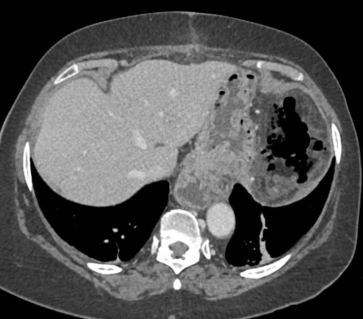 CTisus Case Studies