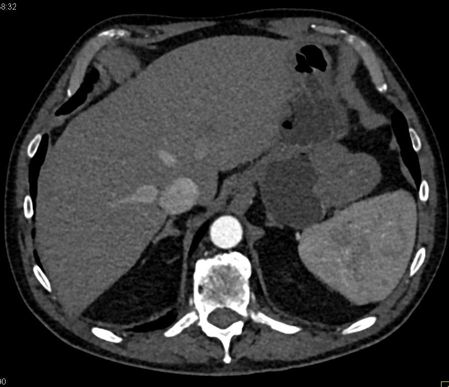 CTisus Case Studies