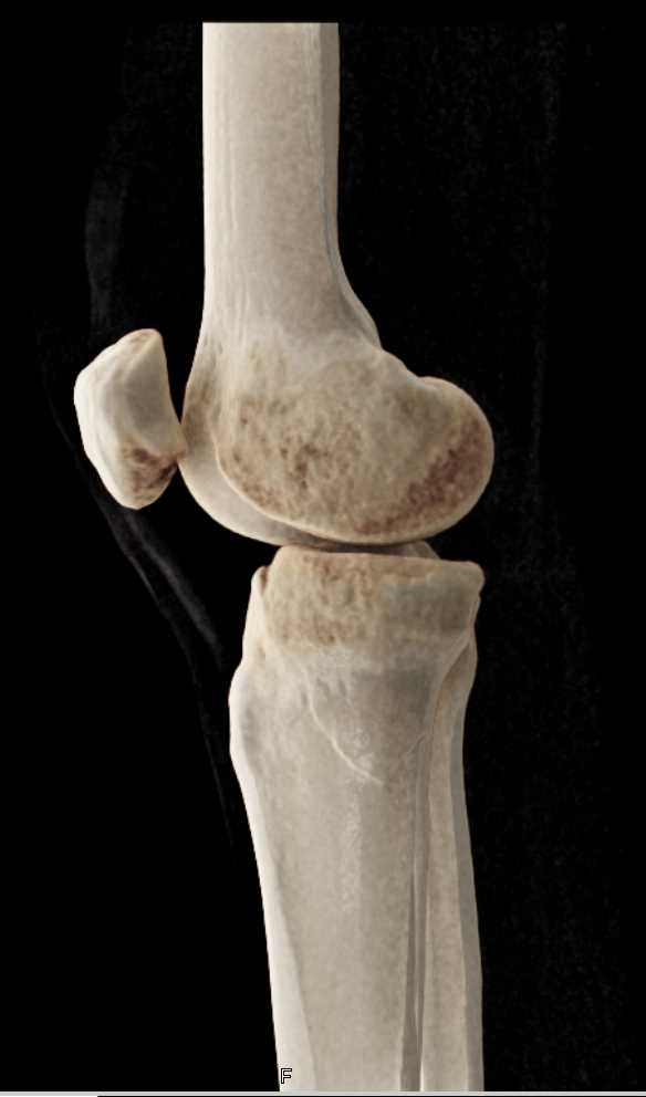 CTisus Case Studies