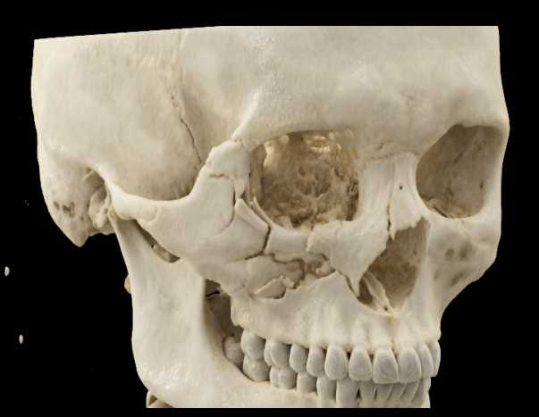 CTisus Case Studies