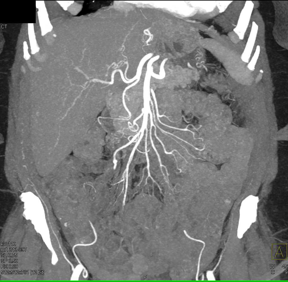 CTisus Case Studies