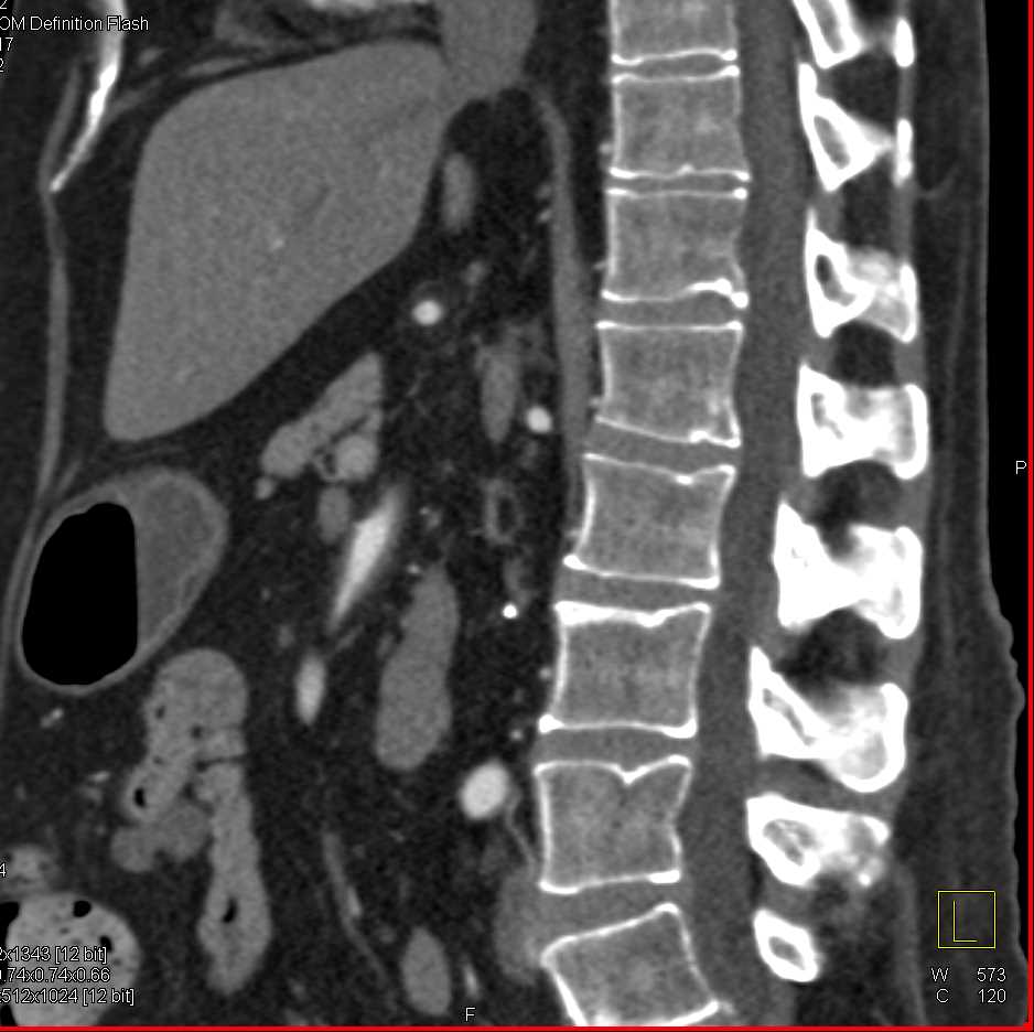 CTisus Case Studies