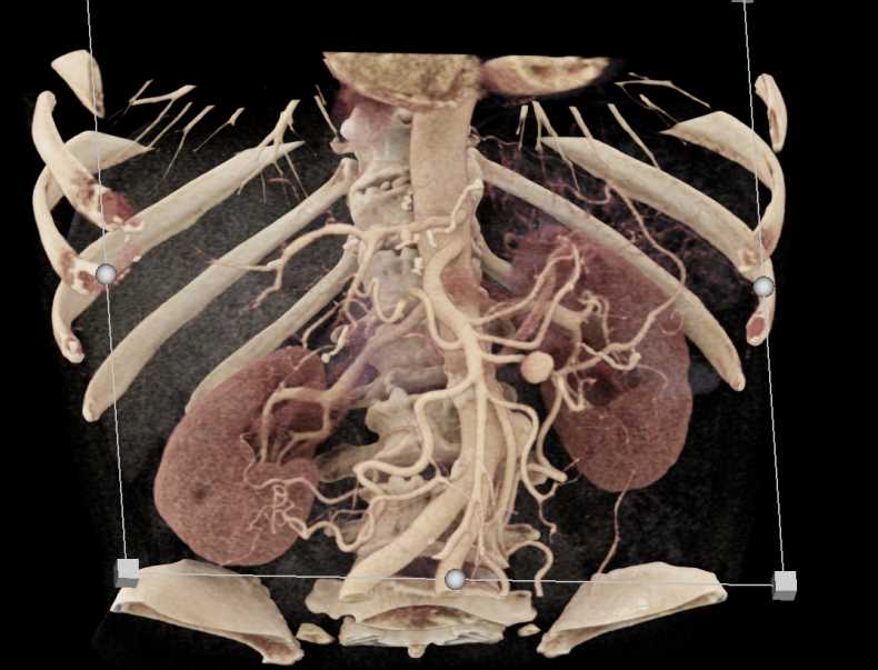 CTisus Case Studies