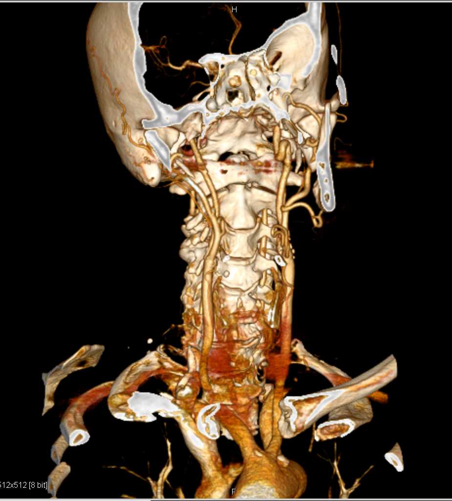 CTisus Case Studies