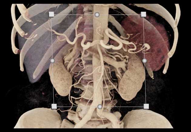 CTisus Case Studies