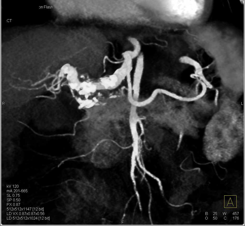 CTisus Case Studies