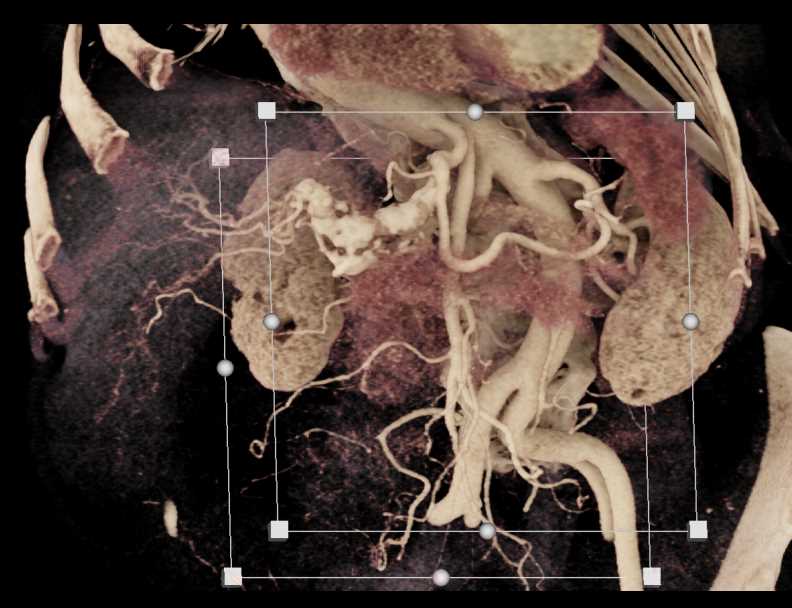 CTisus Case Studies