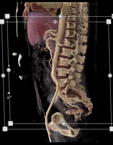 CTisus Case Studies