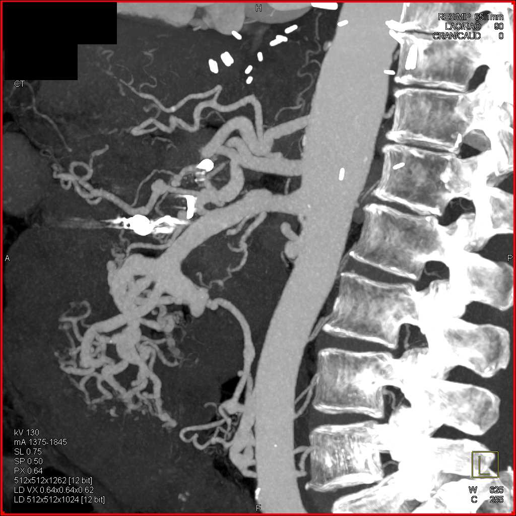 CTisus Case Studies