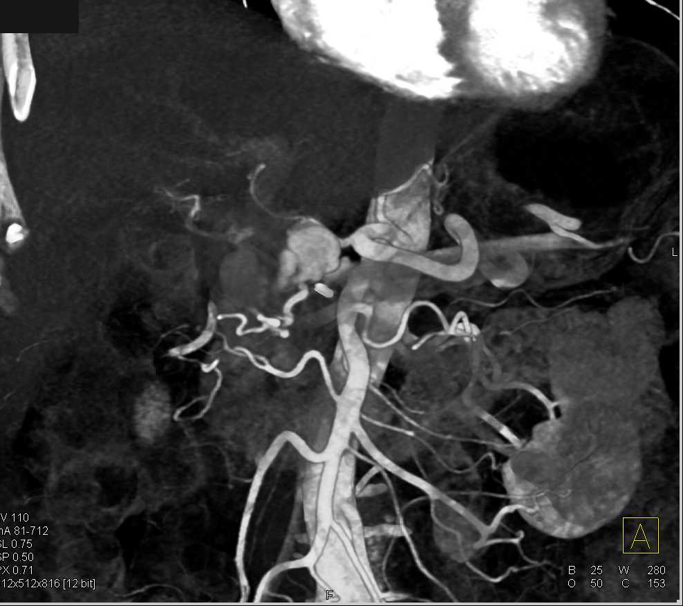 CTisus Case Studies