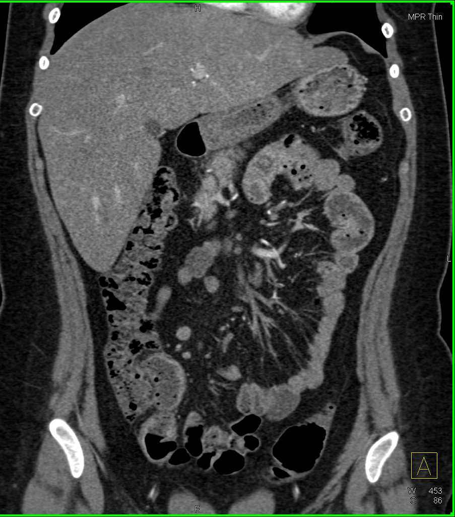 CTisus Case Studies