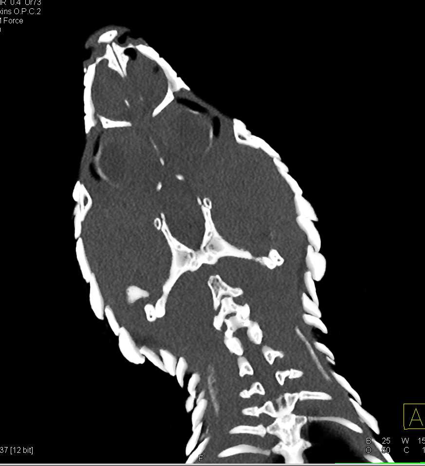 CTisus Case Studies