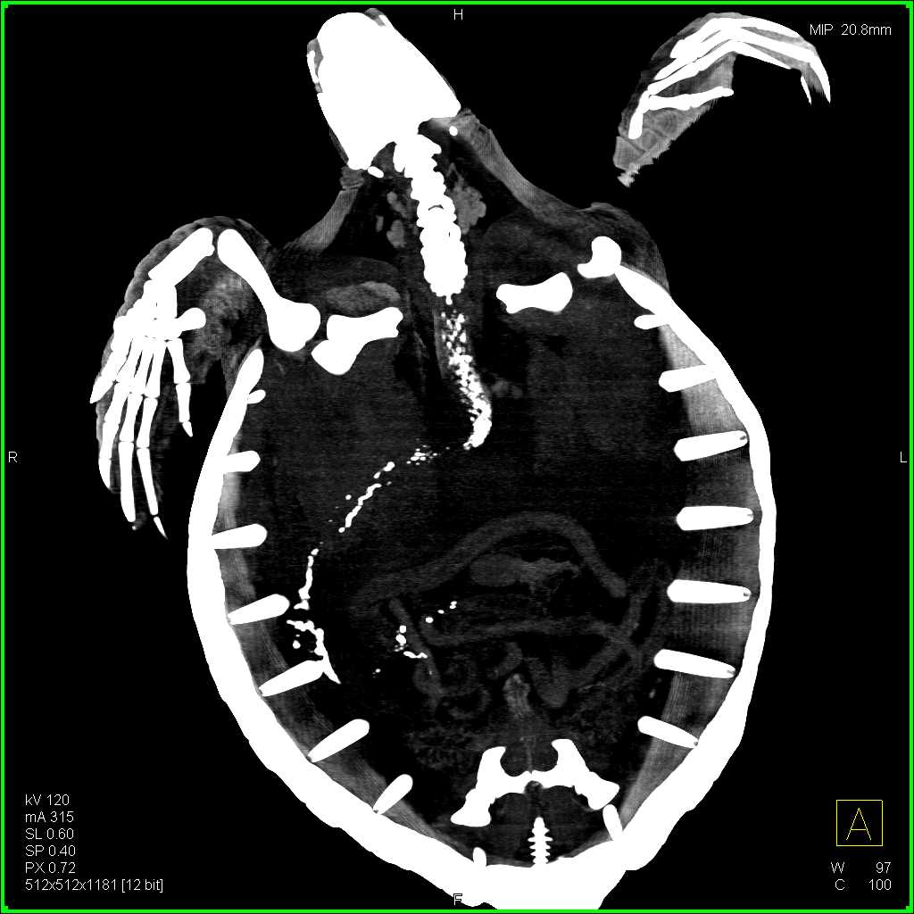 CTisus Case Studies