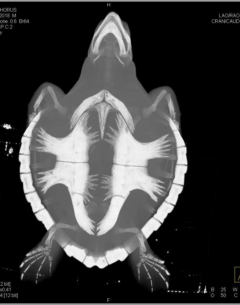 CTisus Case Studies