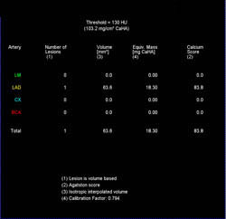 Plaque in LAD - CTisus CT Scan