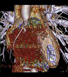 Error in Data Quality - CTisus CT Scan