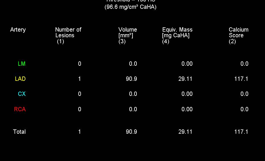 Elevated Agatston Score without Critical Stenosis - CTisus CT Scan