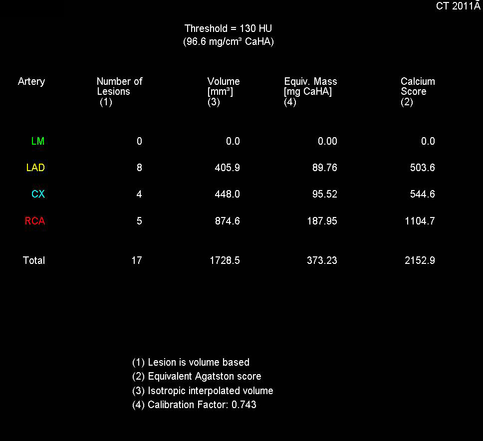 CCTA: Agatston Score of 2152 With Multiple Vessel Stenosis - CTisus CT Scan