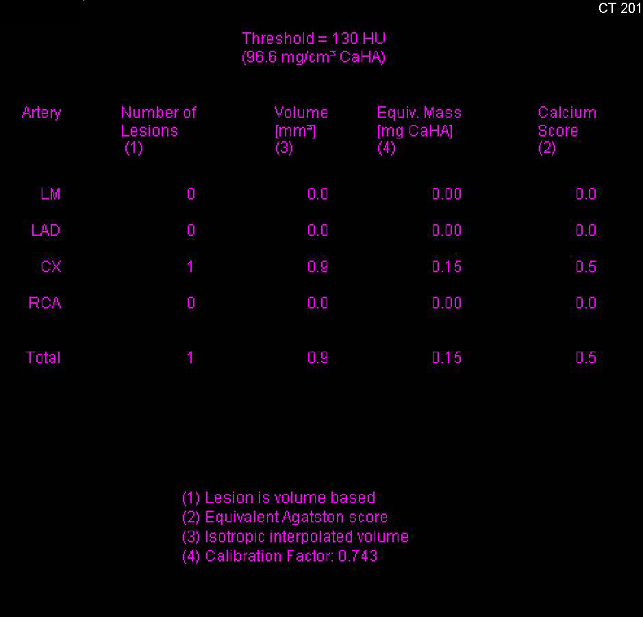 CCTA: High Grade Left Anterior Descending Coronary Artery (LAD) Stenosis - CTisus CT Scan