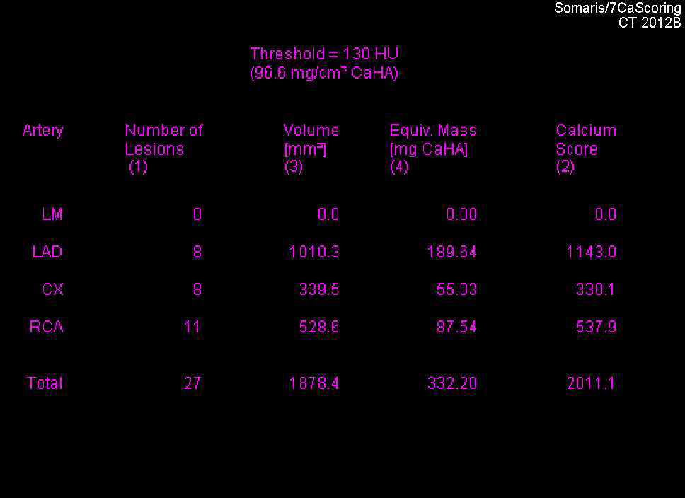 CCTA: Agatston Score of 2011 with Corresponding CTA - CTisus CT Scan