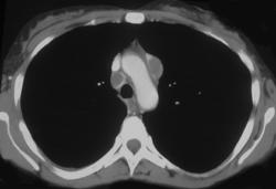 Mai - CTisus CT Scan