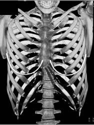 Classic Anatomy - CTisus CT Scan