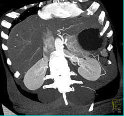 Look at Problem Solving Results - CTisus CT Scan