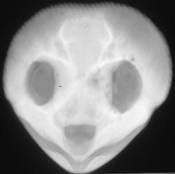 Turtle With Infection of Left Orbital Rim - CTisus CT Scan