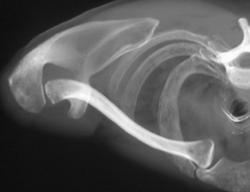 Normal Clavicle and S/c and A/c Joints - CTisus CT Scan