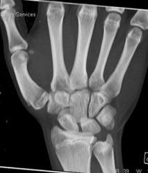 Normal - CTisus CT Scan