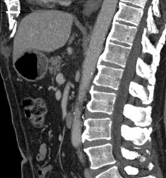 Dish - CTisus CT Scan