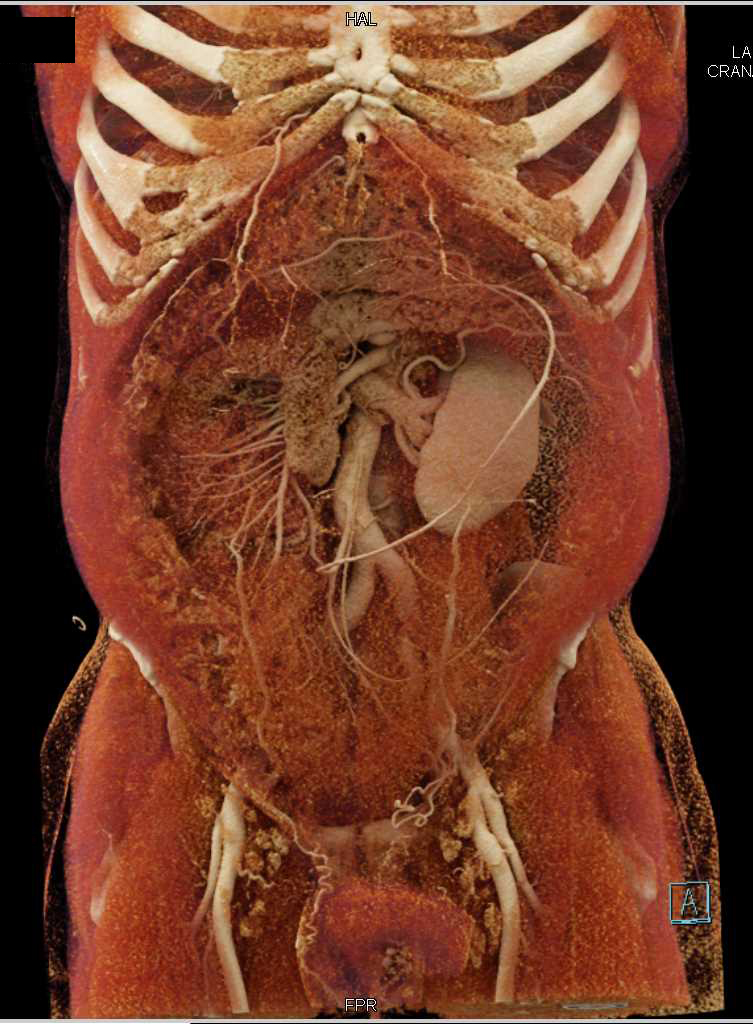 Detailed Vascular and Muscle Mapping with Cinematic Rendering