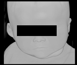 Volume Rendering to Accentuate Skin - CTisus CT Scan