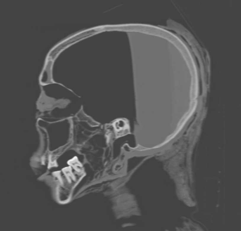 Mummy Skull - CTisus CT Scan