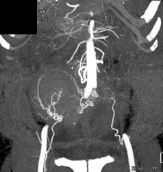 ct ctisus vasculature prominent ovarian studies case scan