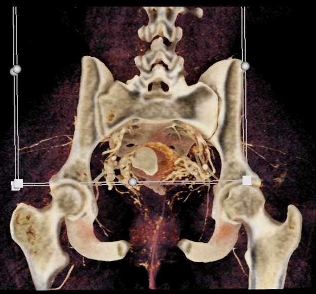 CTisus Case Studies