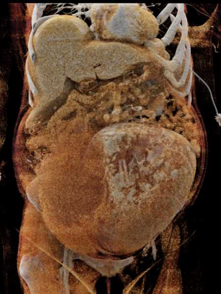 CTisus Case Studies