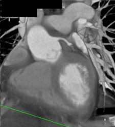 ??? - CTisus CT Scan