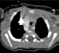 Right Sided Arch - CTisus CT Scan