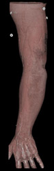 CTA Arm With Transparent Rendering - CTisus CT Scan