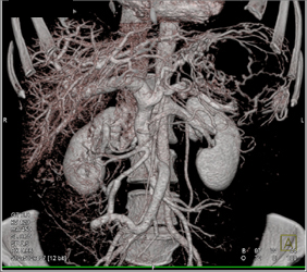 Gastric Anatomy - CTisus CT Scan