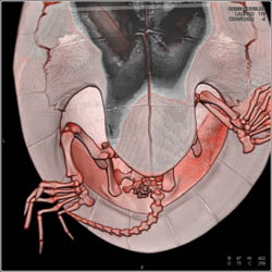 Normal Sea Turtle - CTisus CT Scan