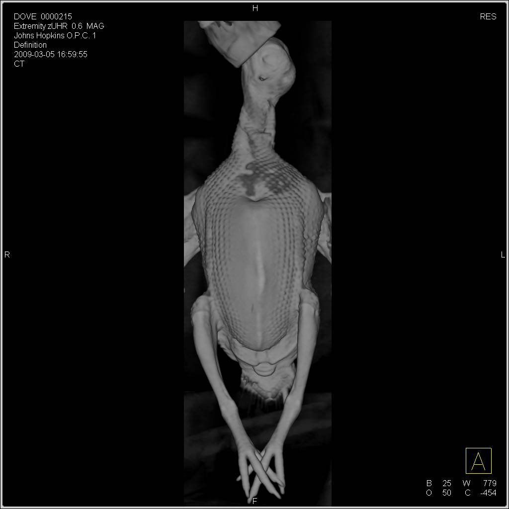 3D Imaging of a Dove Who Was Feeling Poorly - CTisus CT Scan