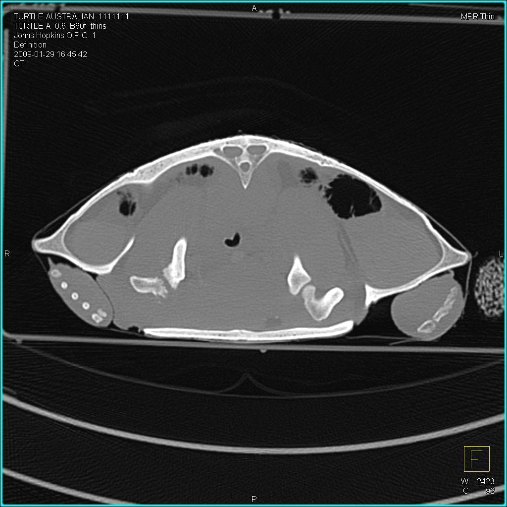 Osteomyelitis of shoulder joint in a turtle - CTisus CT Scan