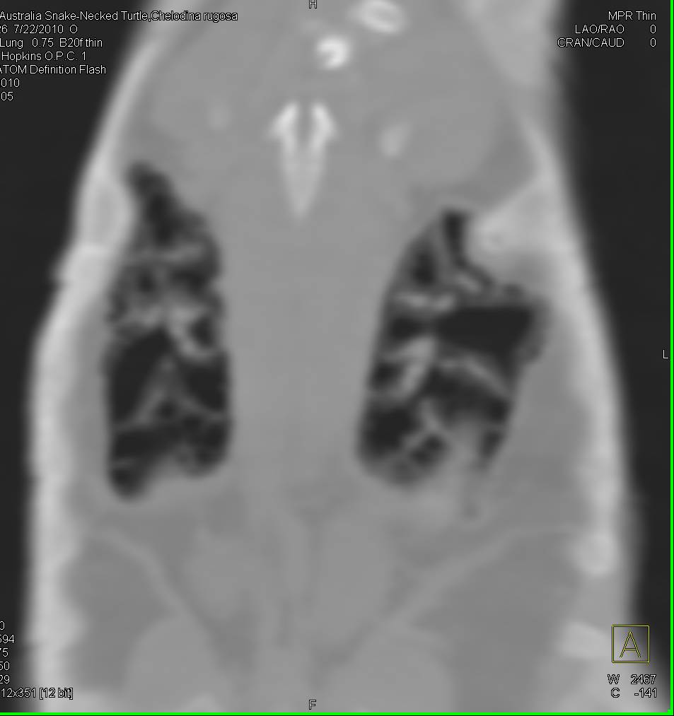 Turtle With Mycobacterium avium/intracellulare (MAI) Infection - CTisus CT Scan