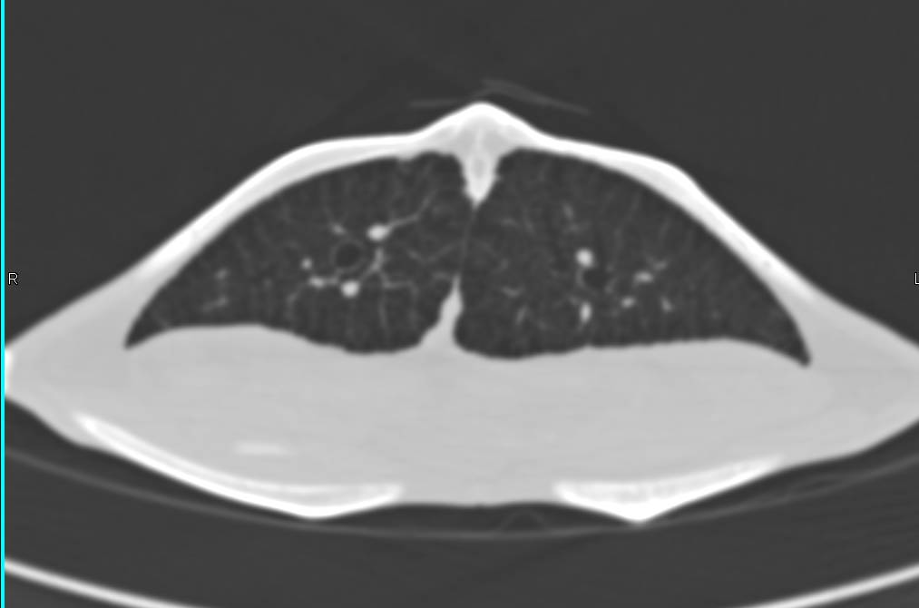 Brewer Turtle with 3D Mapping - CTisus CT Scan